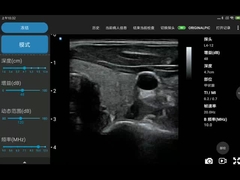 256 linii skanowania Ipad przetwornik ultradźwiękowy bezprzewodowa sonda ultradźwiękowa do PICC