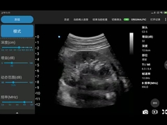 Przenośne skanery ultradźwiękowe Wi-Fi 3,6 MHz z oznaczeniem CE JPEG BMP PNG MPEG-4