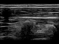 WiFi 12,6 cm Zdalne przenośne urządzenie ultrasonograficzne Dopplera 30 kl./s