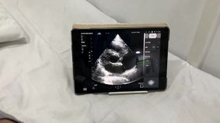Bezprzewodowa sonda ultradźwiękowa z podwójną głowicą do diagnostyki kardiologicznej i POCUS