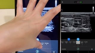 Liniowa sonda ultradźwiękowa Golead do żyły podstawnej