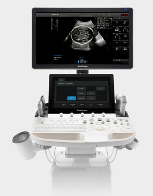 kupować Wózek do ultrasonografii SonoScape oparty na sztucznej inteligencji P60 Exp online manufacture