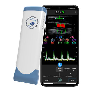 kupować Bezprzewodowy ręczny skaner ultradźwiękowy 12 MHz dla iPhone'a i iPada | Elektroniczna, liniowa sonda kolorowego dopplera online manufacture