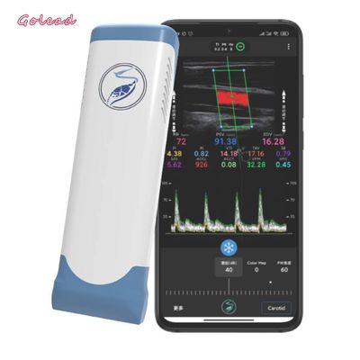 kupować Bezprzewodowy przenośny ultrasonograf z elektroniczną matrycą liniową Wifi 12 MHz online manufacture