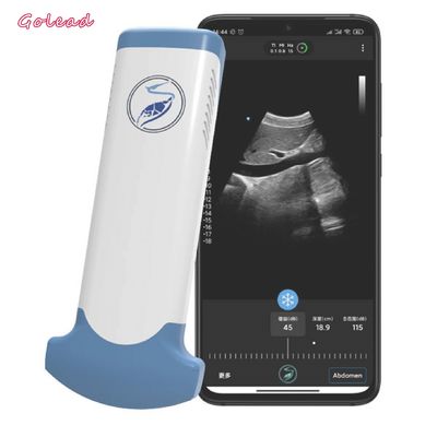 kupować Bezprzewodowe urządzenie ultradźwiękowe Electronic Convex Array do telefonu komórkowego online manufacture