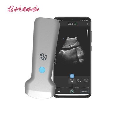 kupować Zatwierdzona przez CE elektroniczna sonda USG z wypukłą matrycą USG dla systemu Android online manufacture