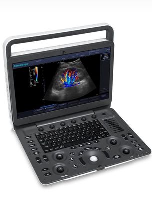 kupować 15,6-calowy ultrasonograf LED Sonoscape E1 Exp Ultradźwięk BW online manufacture