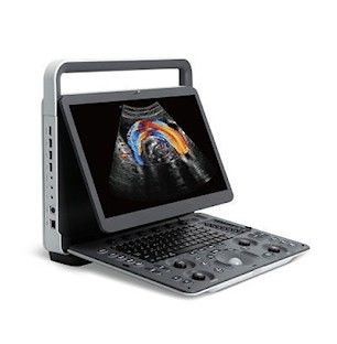 kupować Przenośny ultrasonograf SonoScape E2 PRO do obrazowania panoramicznego online manufacture