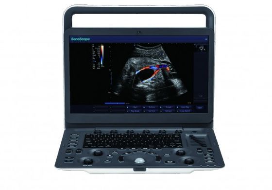 kupować 7 poziomów obrazowania Przenośny aparat ultrasonograficzny SonoScape E3 z monitorem o przekątnej 15,6 cala online manufacture