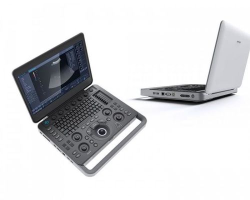kupować Smart Sight Laptop Ultrasonograf SonoScape 500 GB z 15,6-calowym wyświetlaczem LCD online manufacture