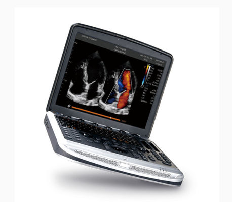 kupować Zatwierdzony przez FDA przenośny ultrasonograf Chison SonoBook 8 do echokardiografii online manufacture