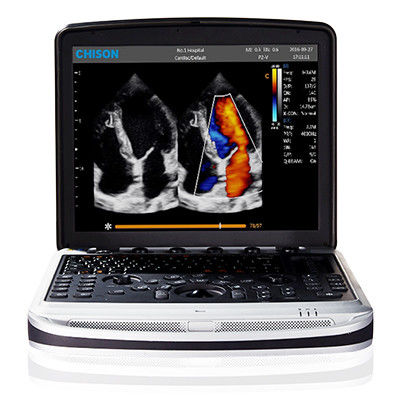 kupować Łatwy do przenoszenia ultrasonograf 4D Chison SonoBook 9 online manufacture