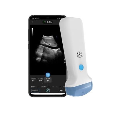 kupować Wyjście HDMI Bezprzewodowy Konweksowy Przenośny Skaner Ultrasoniczny 3,6MHz Przenośny Doppler Kolorowy POCUS Ultrasoniczny online manufacture