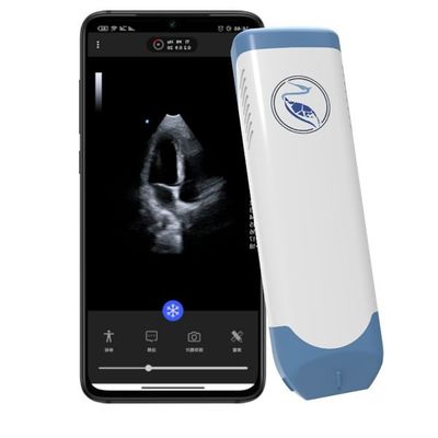 kupować Głębokość 18,9 cm Ręczny skaner ultrasonograficzny do iPhone'a 3,6 MHz online manufacture