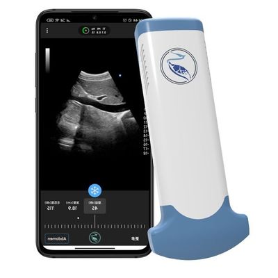 kupować Ręczny skaner ultrasonograficzny MPEG-4 medycyny ratunkowej do diagnostyki klinicznej online manufacture