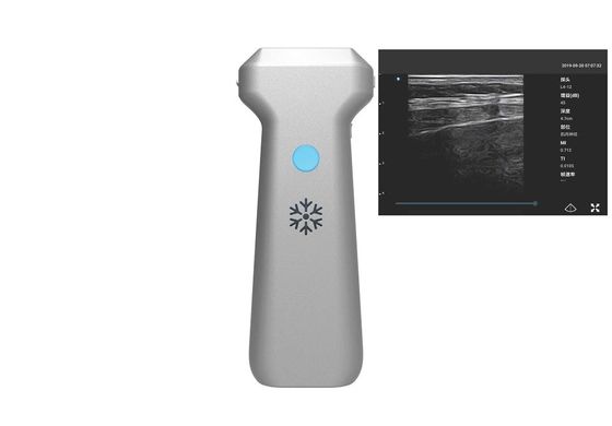 kupować Sonda liniowa Bezprzewodowa przenośna ultrasonografia 32-kanałowa online manufacture