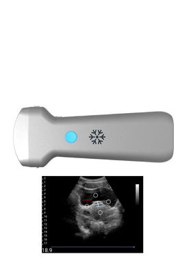 kupować Ultradźwiękowa wypukła bezprzewodowa sonda ultradźwiękowa do ginekologii online manufacture
