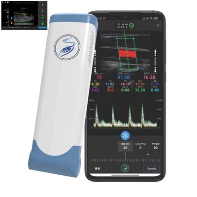 kupować 256 linii skanowania Ipad przetwornik ultradźwiękowy bezprzewodowa sonda ultradźwiękowa do PICC online manufacture