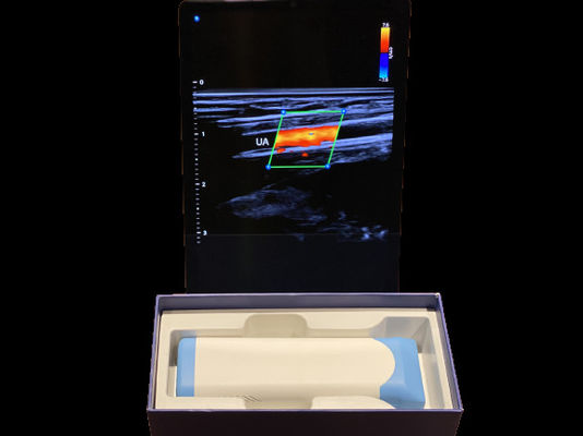 kupować Zaawansowany przenośny skaner ultradźwiękowy o masie 0,2 kg z baterią 3000 mAh do celów medycznych online manufacture