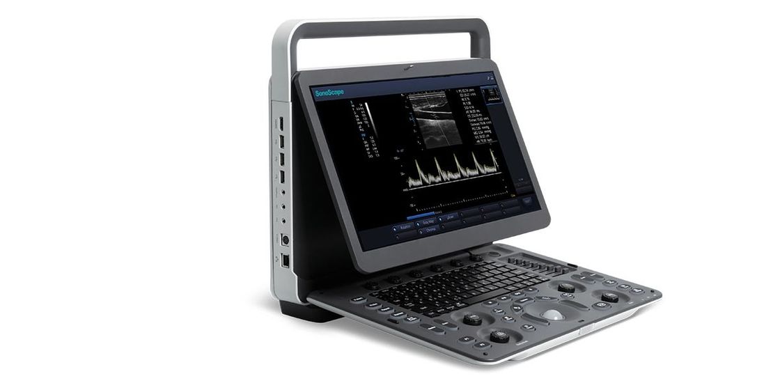 15,6-calowy LED SonoScape Przenośny kolorowy ultrasonograf dopplerowski BW Ultrasonograf