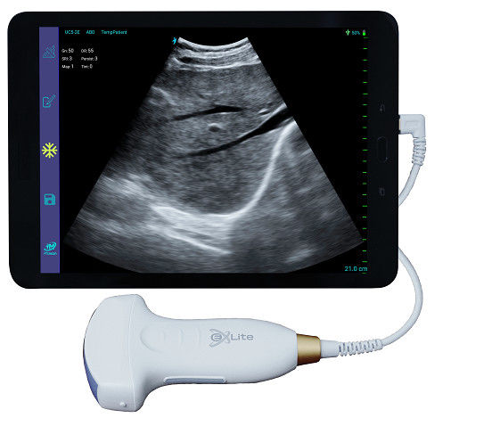 Ręczny ultrasonograf Electronic Convex Array Color Doppler 3,5 MHz