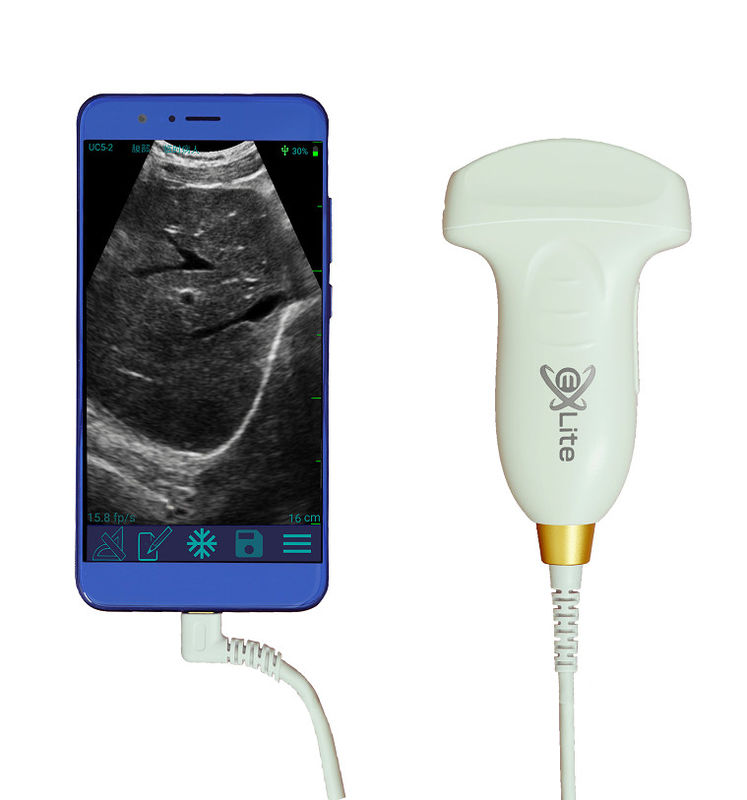 Ręczny ultrasonograf Electronic Convex Array Color Doppler 3,5 MHz