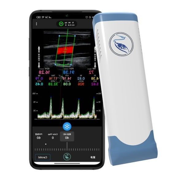Bezprzewodowy ręczny ultrasonograf Echo Color Doppler 100 klatek