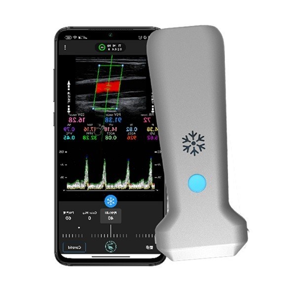 Bezprzewodowy liniowy ręczny skaner ultradźwiękowy z certyfikatem CE | Przenośna sonda ultradźwiękowa z kolorowym dopplerem 8,3 MHz