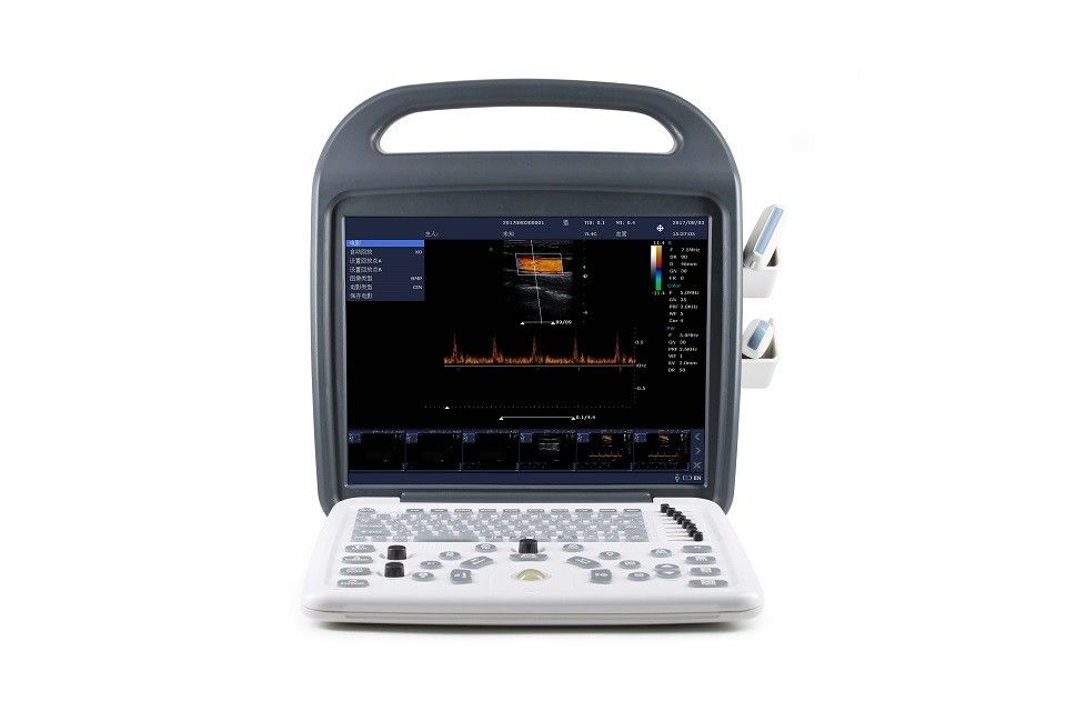 15-calowy monitor LCD o wysokiej rozdzielczości Kolorowy ultrasonograf Dopplera Przenośny 7,5 kg