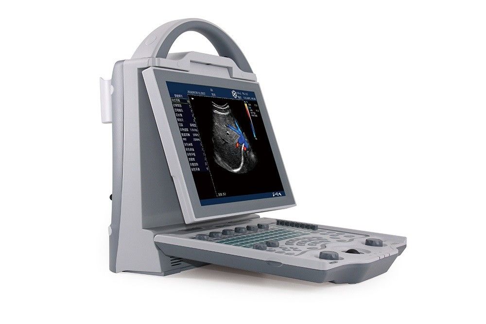 16 GB Podstawowy system ultrasonograficzny 2D do laptopa z kolorowym dopplerem dla kobiet w ciąży