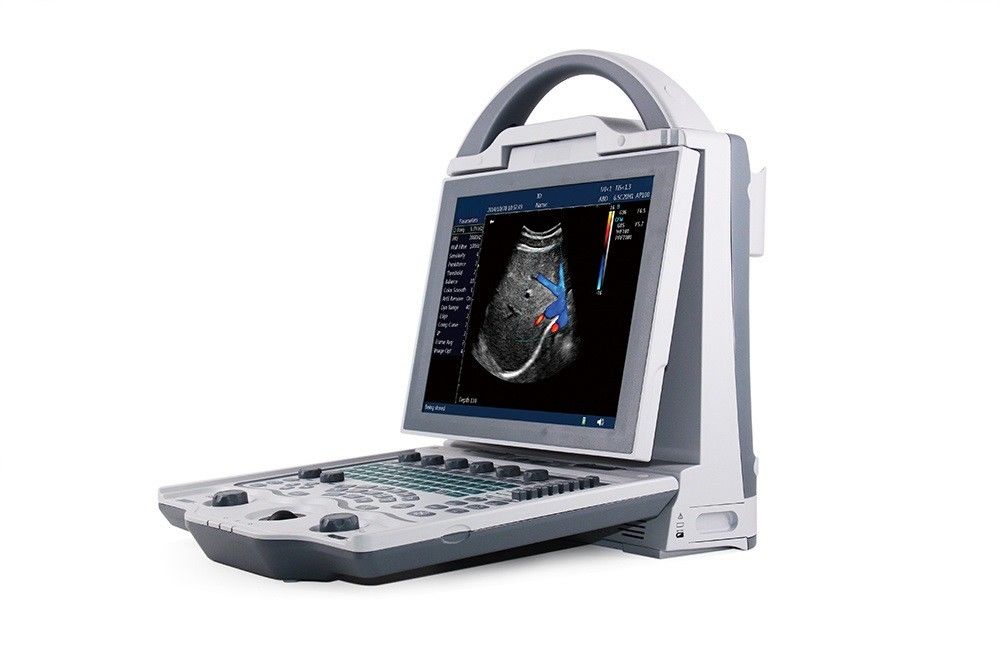 16 GB Podstawowy system ultrasonograficzny 2D do laptopa z kolorowym dopplerem dla kobiet w ciąży